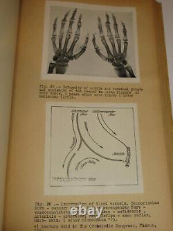 Wwii German Army Cold Injuries Book! Dr Hans Killian, Images, Graphiques! Vtg Rare